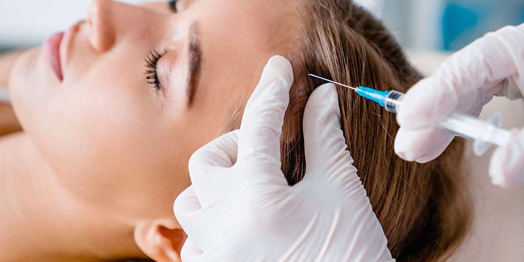 Trasplante capilar Barcelona Trasplante capilar Barcelona