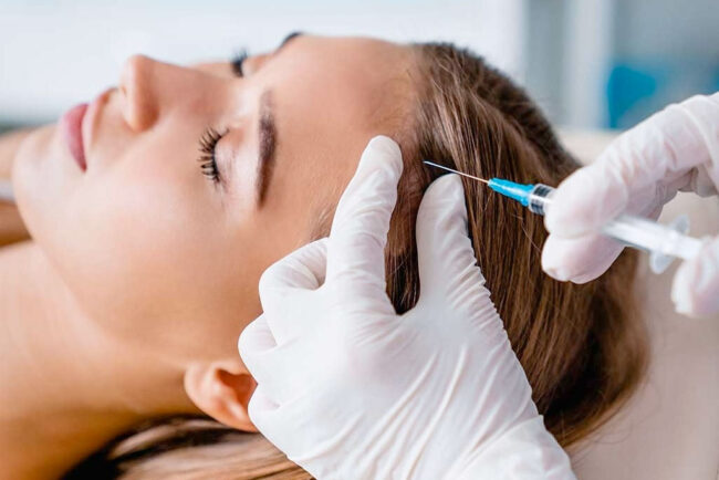 Trasplante capilar Barcelona Trasplante capilar Barcelona