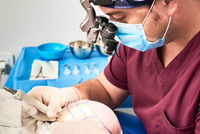 clinica-capilar-barcelona-por-que-elegir Por qué elegir una clínica capilar en Barcelona