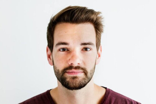 tratamientos-no-quirurgicos-caida-pelo