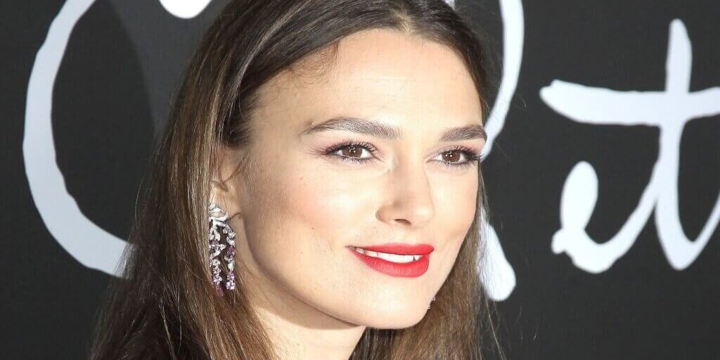 Injerto capilar famosas Injertos capilares famosas