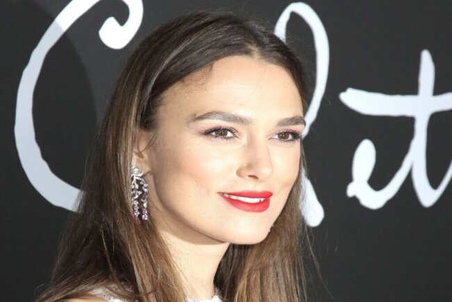 Injerto capilar famosas Injertos capilares famosas